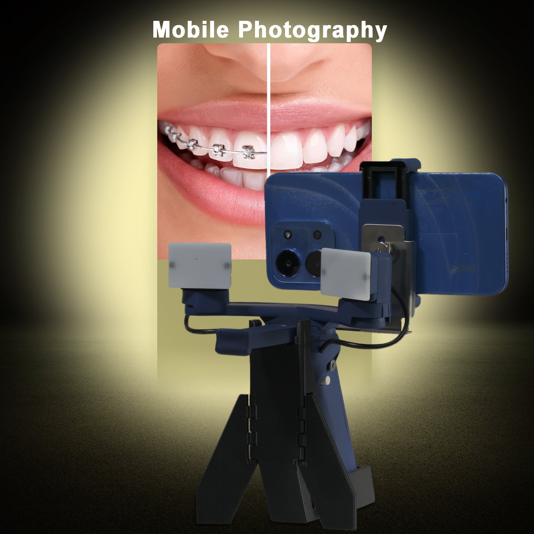 Dental Mobile Photography